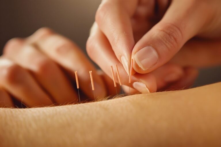 Exploring the Best TCM Acupuncture: Healing Through Traditional Chinese Medicine